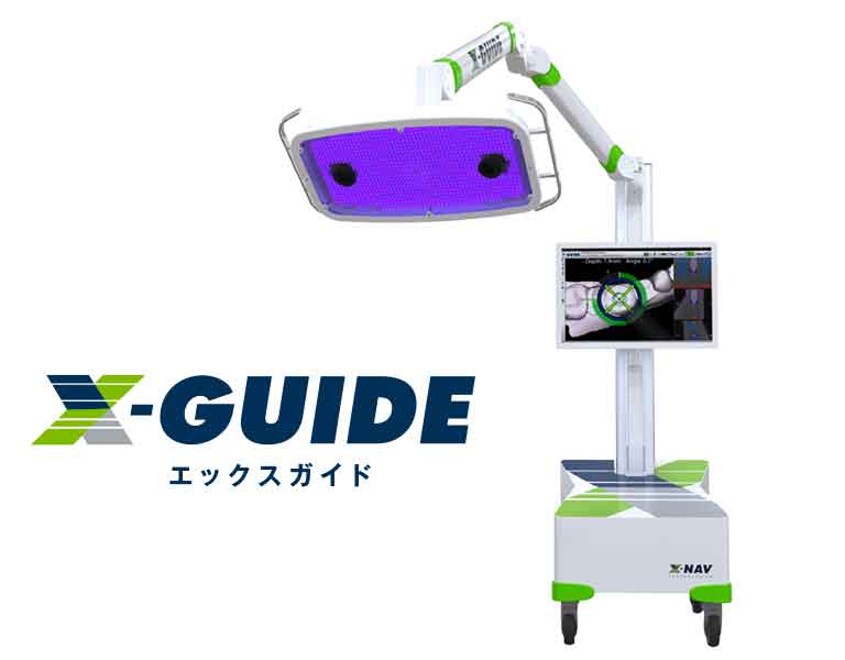 Xガイドを必ず使用